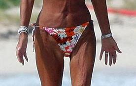 暴瘦后皮肤松弛照片,真实写照与应对策略